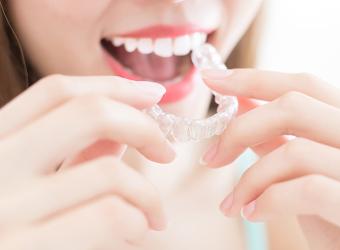 Alternative to Braces for Teens