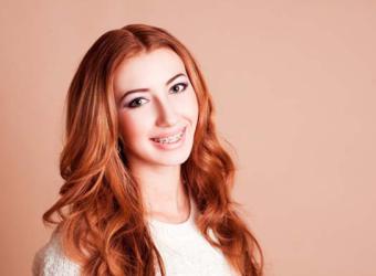 Repairing Front Teeth with a Full Mouth Reconstruction